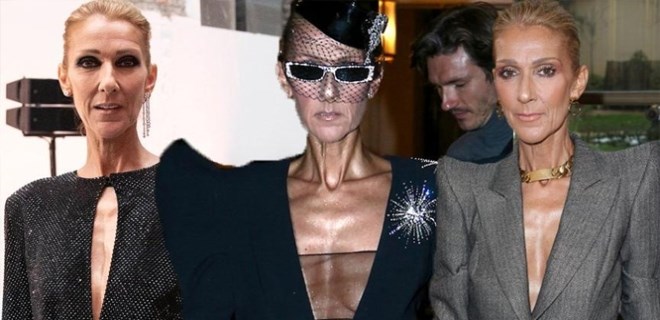 Celine Dion görüntüsüyle endişelendirdi